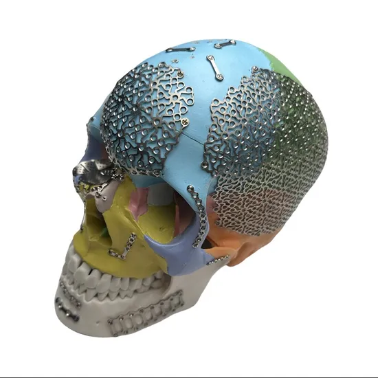 Medical Bone Fixation Mini Titanium Implant Orthopedic Surgical Maxillofacial Locking Plate Screw 